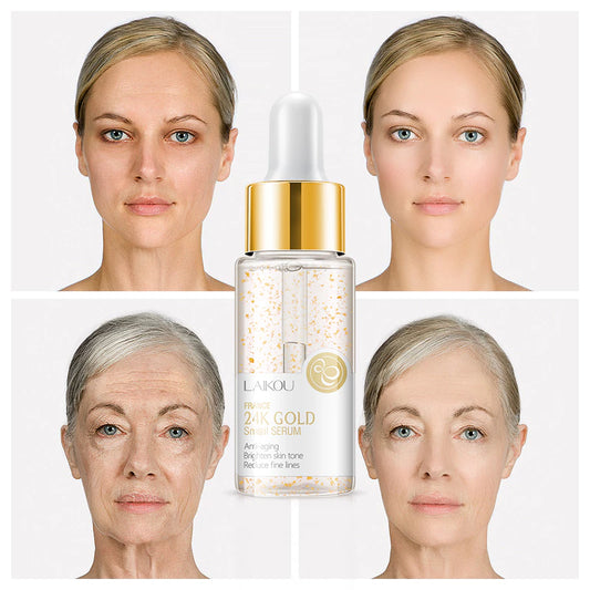 Sérum Facial 24K Gold Caracol CHARM VITAL – Anti-Idade, Firmeza e Redução de Poros